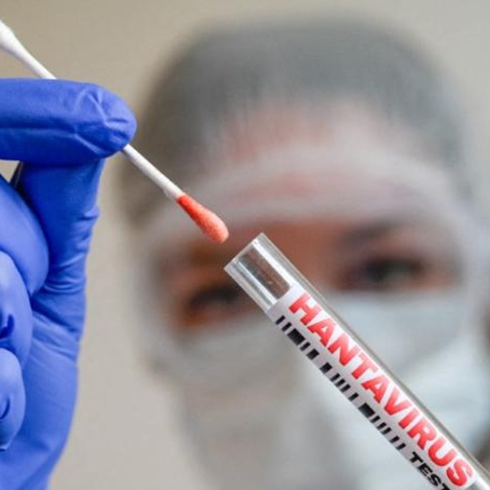 ALERTA-DE-LA-OMS-HANTAVIRUS-EXTREMADAMENTE-CONTAGIOSO-AL-COMENZAR_.jpg