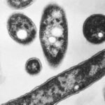 LEGIONELOSIS: DEFINICIÓN Y MÉTODOS DE PREVENCIÓN