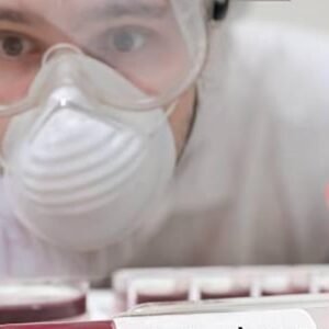 SOSPECHAS-DE-ANTRAX-EN-HAITI-REFUERZAN-VIGILANCIA-EPIDEMIOLOGICA_.jpg